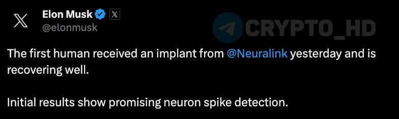 ThrinyTri's tweet photo. 🧠 Elon Musk Neuralink has successfully implanted an implant in the human brain. 

“The patient feels well and is recovering.”

The Neuralink shitcoin increased by 3,400% after the news. https://t.co/MclfI1wuMO