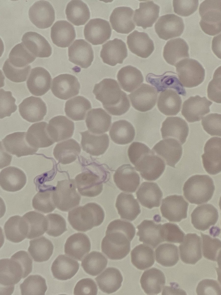 Can anyone narrow down an identification for these just based on morphology? Imagine these little guys circulating through your body - yikes😳 #PathTwitter #microbiology #medtwitter #pathX