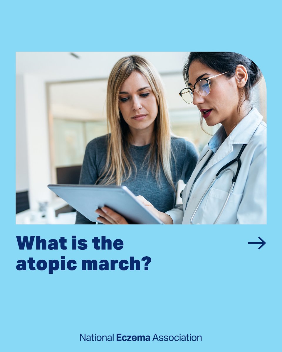 nationaleczema's tweet photo. What is the #atopicmarch? Dr. Ari Zelig joins us to answer these questions and more on this episode of NEA's #podcast, #EczemaOutLoud. โ
โ
Listen now on the NEA website or on your favorite podcast streaming service: https://t.co/8aY9Xz5vxCโ
#GetEczemaWise #DermTwitter https://t.co/1TLLdHW0ME