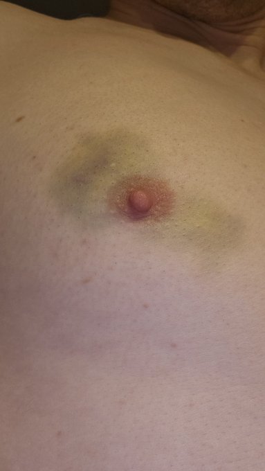 Watch 🛸Ｃｏｓｍｉｃ Ｂｒｏｃｃｏｌｉ🥦 ℕ𝕠𝕨 𝕠𝕟𝕝𝕪 $𝟞.𝟞𝟡's leaked NSFW photo on TwXstars