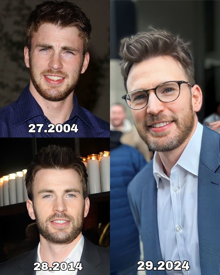 Featured - Chris Evans Plastic Surgery Doomsday
