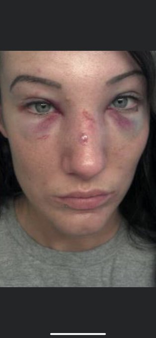 Happy Anniversary @MiaYim @aiwrestling 😅💀  I&rsquo;m going live tonight on Twitch in 1 hour!  https://t.co/4qIR0Dz4Q4<a class="tags" target="_blank" title="On Twitter" href="/?out=eyJ0eXAiOiJKV1QiLCJhbGciOiJIUzUxMiJ9.eyJpYXQiOjE3MjA2OTM5MjQsImlzcyI6InR3cG9ybnN0YXJzLmNvbSIsIm5iZiI6MTcyMDY5MzkyNCwiZXhwIjoxNzUyMjI5OTI0LCJyZWRpcmVjdF91cmwiOiJodHRwczovL3R3aXR0ZXIuY29tL01pYVlpbSJ9.IUVHlSv3vB-U8RIyWZSJiq--LK-Kkm1NWZsNn1pFxCk5rZqyg4Iq4u-SuddeDgkHvCJx-dmQq6AH0cuCSxFihQ">@MiaYim</a><a class="tags" target="_blank" title="On Twitter" href="/?out=eyJ0eXAiOiJKV1QiLCJhbGciOiJIUzUxMiJ9.eyJpYXQiOjE3MjA2OTM5MjQsImlzcyI6InR3cG9ybnN0YXJzLmNvbSIsIm5iZiI6MTcyMDY5MzkyNCwiZXhwIjoxNzUyMjI5OTI0LCJyZWRpcmVjdF91cmwiOiJodHRwczovL3R3aXR0ZXIuY29tL2Fpd3Jlc3RsaW5nIn0.FIT73gI_E9QRQEQweHX40TE-EEsLZrKh8sszJkKWVu1676ivlLayjbd-o8f32xVi-xruDFobhnTv9dcM6BAkag">@aiwrestling</a><a href="/tag/hotgirltwitch"class="tags"><span>#hotgirltwitch</span></a>