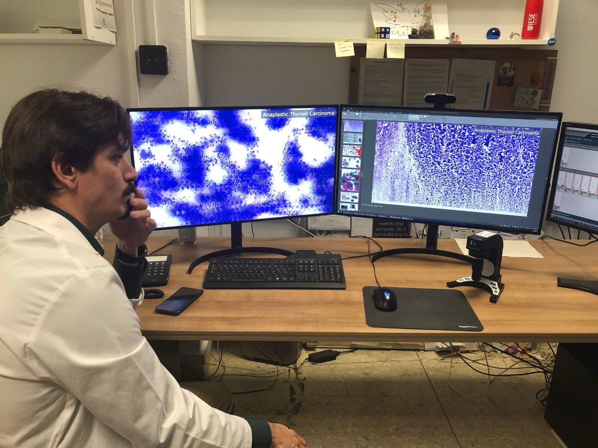 ICS. Generalitat (@icscat) on Twitter photo <a href="/vallhebron/">Vall d'Hebron</a> L’#icscat ha desenvolupat algoritmes d’intel·ligència artificial que ja s’han utilitzat en el diagnòstic de prop de 600 casos sospitosos de càncer de mama i es treballa per fer servir aquesta tecnologia, també, en el diagnòstic de càncer de pulmó. #ICSfluencers #IA <a href="/vallhebron/">Vall d'Hebron</a> L’#icscat ha desenvolupat algoritmes d’intel·ligència artificial que ja s’han utilitzat en el diagnòstic de prop de 600 casos sospitosos de càncer de mama i es treballa per fer servir aquesta tecnologia, també, en el diagnòstic de càncer de pulmó. #ICSfluencers #IA