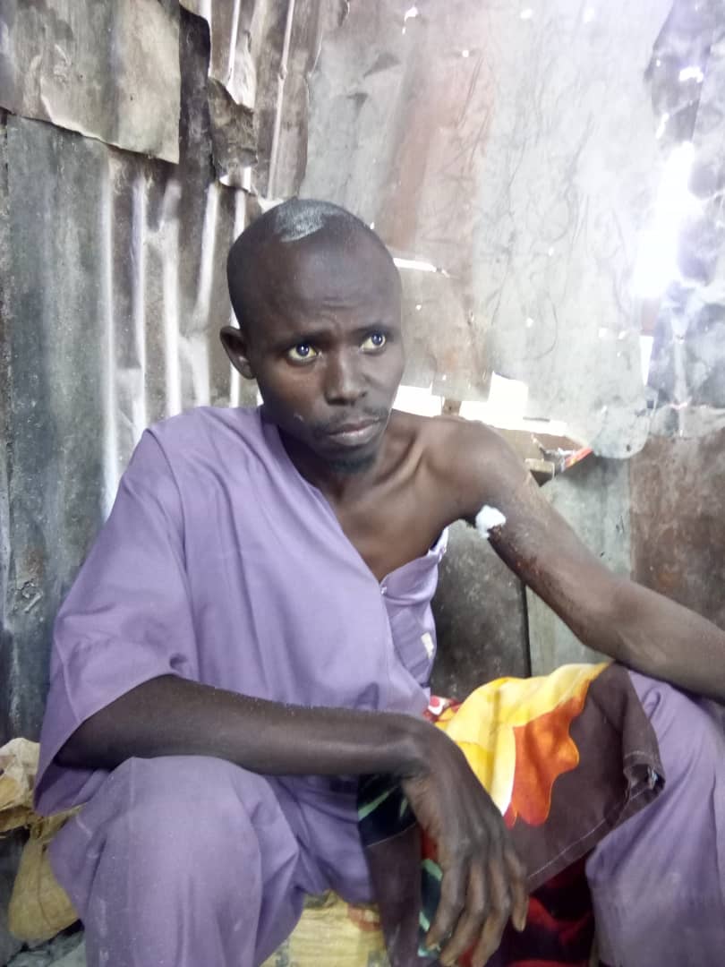 *A PASSIONATE APPEAL FOR MEDICAL ASSISTANCE FOR USMAN ALIYU.* 
The bearer Usman Aliyu is a deaf from Kaduna State,  has a hole in the arms a medical challenge due to an accident in 2004. The wound can heal and re occurs at any time causing pain and discomfort. This phenomenon,