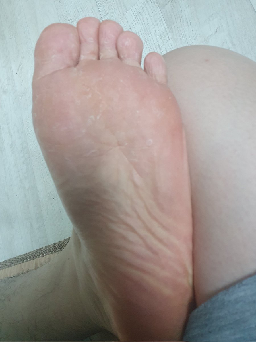 y23bs's tweet photo. #남자발 #malefeet #barefeet #풋플 https://t.co/7sjNEkoLTr