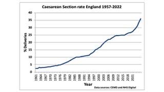 ….and CS rates continue to rise so it maybe some credit to maternity services health professionals that maternal mortality rate from haemorrhage has not increased but still our challenge to reduce number of women dying from childbirth bleeding
