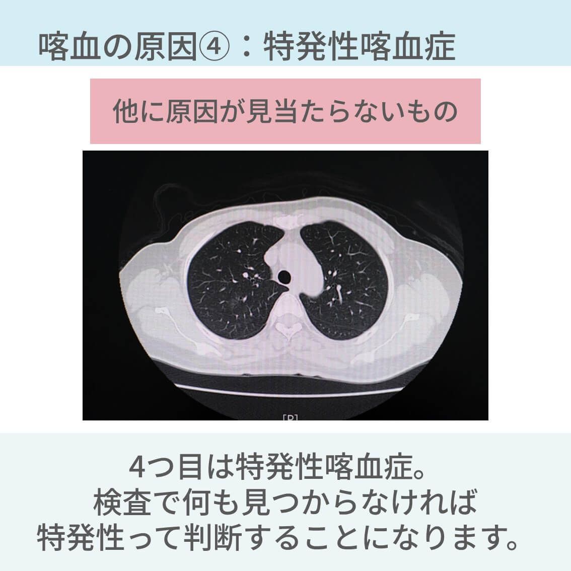 PulmoSheep's tweet photo. 喀血の原因5選
↓
続き https://t.co/RlYvxTwEq3