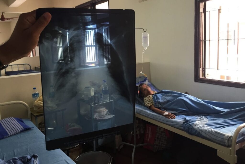 More affordable tuberculosis medication on the horizon; The latest health stories from around the world is.gd/da86Rk