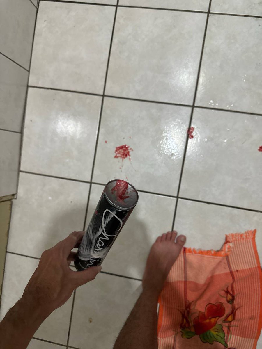 MasterSadico87's tweet photo. O viado se fudeu mtooooo kkkk! Ordenei na chamada que metesse esse tubão aí no cu e ficou toda machucadinha. Saiu dilacerada e toda feliz. Ahh e bancou é claro! #FinDom #Sádico https://t.co/LxY7xZPu2b