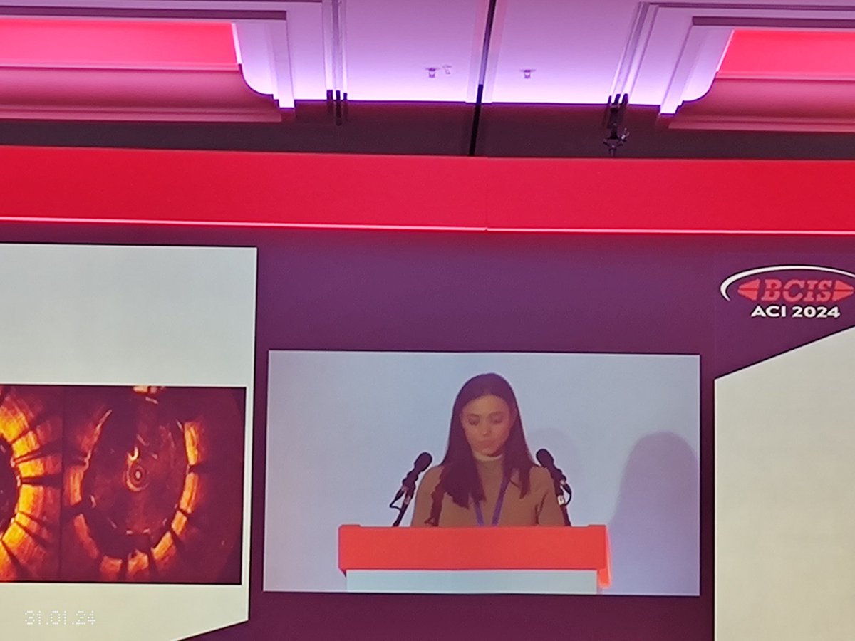uxmsajjad's tweet image. Absolutely brilliant talk by @kliokon on tips for using OCT . The injection technique is legendary!! 👏👏
@EssexCTC #BCISACI