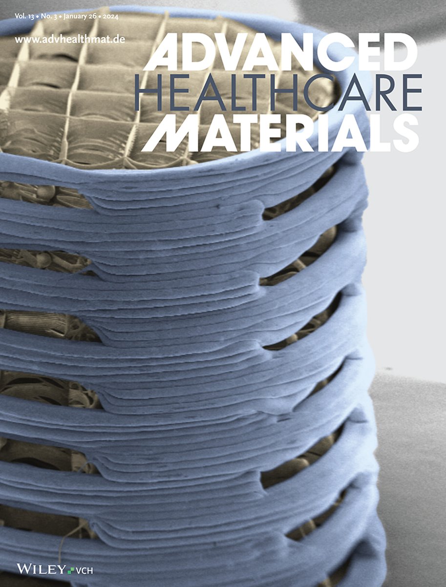 Advanced Portfolio News (@advportfolio) on Twitter photo A hybrid scaffold was developed by <a href="/dannykelly1978/">Danny Kelly</a> and team by merging two different additive manufacturing methods.
The microfibrous core guides bone healing, while a stiff outer shell offers mechanical support and accelerates healing.
Learn more: ow.ly/vKTR50QvPFB A hybrid scaffold was developed by <a href="/dannykelly1978/">Danny Kelly</a> and team by merging two different additive manufacturing methods.
The microfibrous core guides bone healing, while a stiff outer shell offers mechanical support and accelerates healing.
Learn more: ow.ly/vKTR50QvPFB