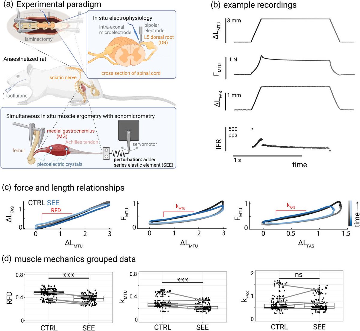 Experimental Physiology (@expphysiol) on Twitter photo Emily M. Abbott (<a href="/DukeUBME/">Duke Biomedical Engineering</a>) et al. investigate changes in muscle spindle firing using added series elastic elements, and characterize the accompanying changes in firing with respect to muscle–tendon unit and muscle fascicle displacements!
📜buff.ly/3UdGfYA Emily M. Abbott (<a href="/DukeUBME/">Duke Biomedical Engineering</a>) et al. investigate changes in muscle spindle firing using added series elastic elements, and characterize the accompanying changes in firing with respect to muscle–tendon unit and muscle fascicle displacements!
📜buff.ly/3UdGfYA
