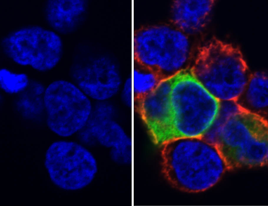 ScienceMagazine's tweet image. Researchers have created an easy-to-use, open-source #bioinformatics pipeline that can detect potential neoantigen targets for #immunotherapy that are shared across patients with cancers, including #melanoma. scim.ag/5Io @ScienceTM