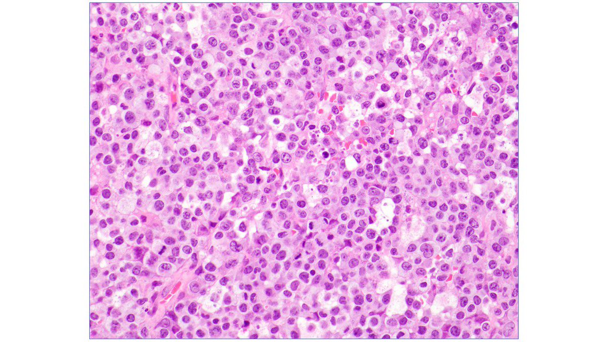 Judith Ferry tweet media