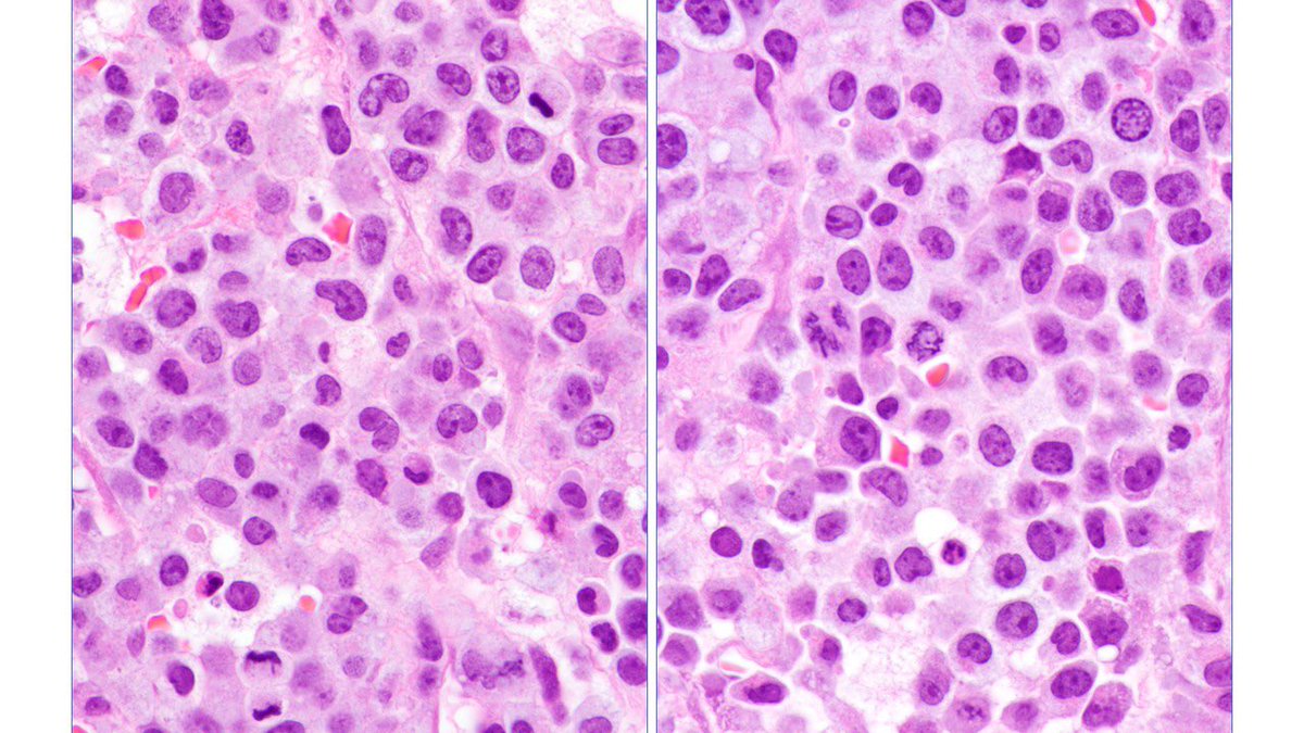 Judith Ferry tweet media