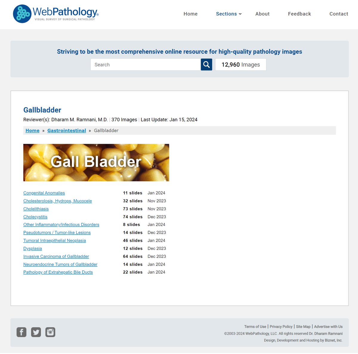 Update in #GIPath Gallbladder pathology updated; 370 images; webpathology.com/category.asp?c…; enjoy🙂#pathtwitter #pathologists