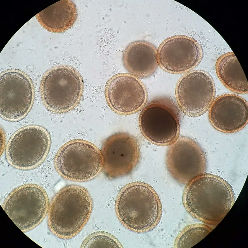 Toxocara canis ova from a canine fecal float. I use a zinc sulfate float solution with specific gravity of 1.175 to perform fecal floats #parasitologia #parasite #animalscience #animalcare #parasitology #microscopy #microscope #biology #stem #vetstudent #DVM #dogtor #vet #vetmed