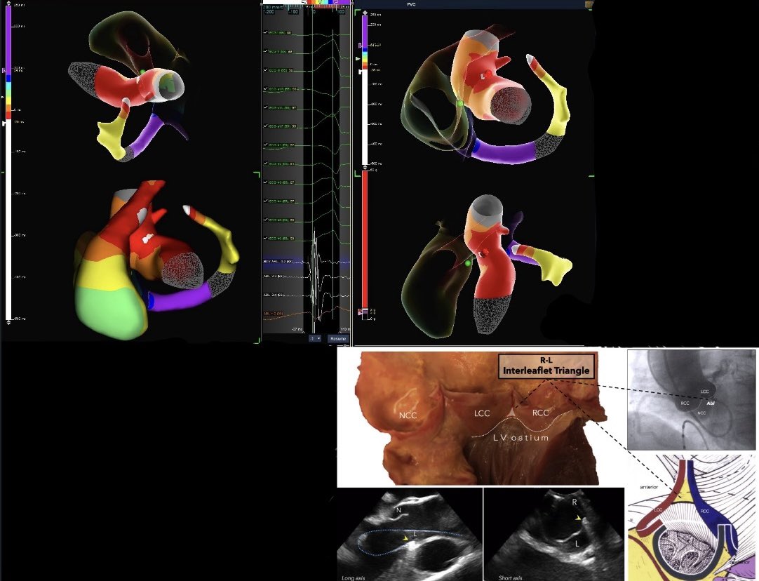 Arek Karagoezian tweet media