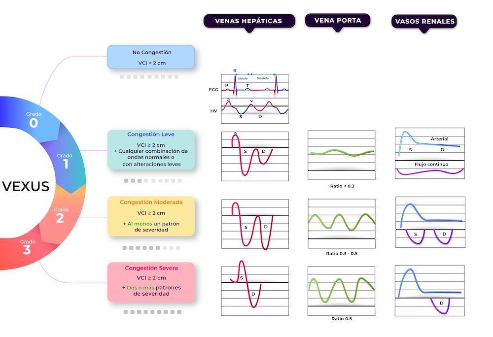 Valoración ultrasonográfica de la congestión venosa: VExUS una herramienta de medicina de precisión a pie de cama
📘 buff.ly/3OXCjIS ◀️
Repaso de la Trukipedia publicada en RETICweb