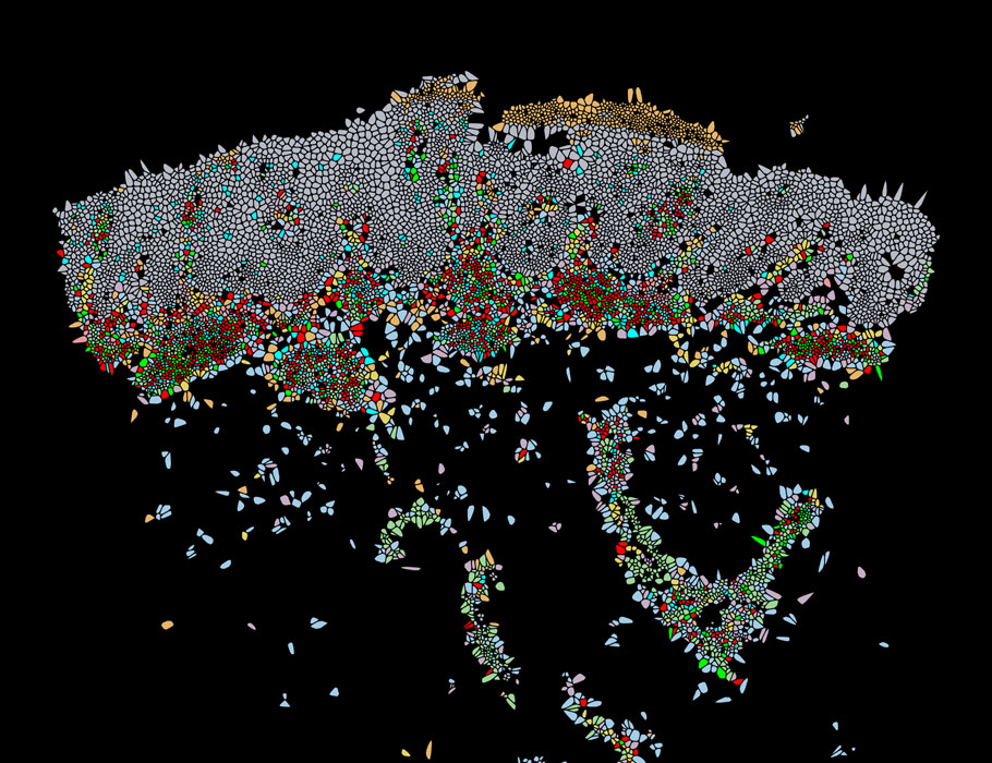 Science Magazine (@sciencemagazine) on Twitter photo A map of T cell activity during a standard form of psoriasis treatment provides new insights into why inhibiting cytokine IL-23 signaling has shown clinical success.
Read more in <a href="/SciImmunology/">Science Immunology</a>: scim.ag/5IP A map of T cell activity during a standard form of psoriasis treatment provides new insights into why inhibiting cytokine IL-23 signaling has shown clinical success.
Read more in <a href="/SciImmunology/">Science Immunology</a>: scim.ag/5IP