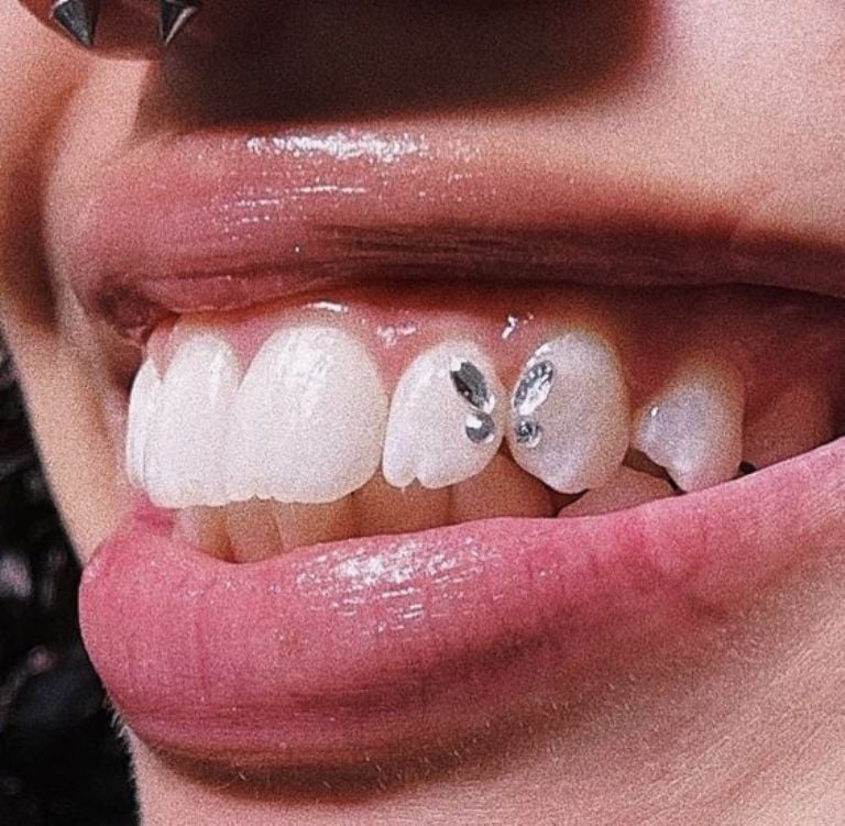 ¡Cuidado con las modas!

Los abalorios dentales están en tendencia, pero debemos saber que, fijar adornos en los dientes puede causar daños al esmalte y convertirse en un refugio para bacterias.

Prioriza la moda sin comprometer la salud dental. 😷🦷