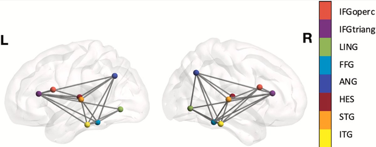 Interesting @CatherineALebel study showing that phonological processing scores positively associated with graph theoretical measures in the language network in preschool children. sciencedirect.com/science/articl…