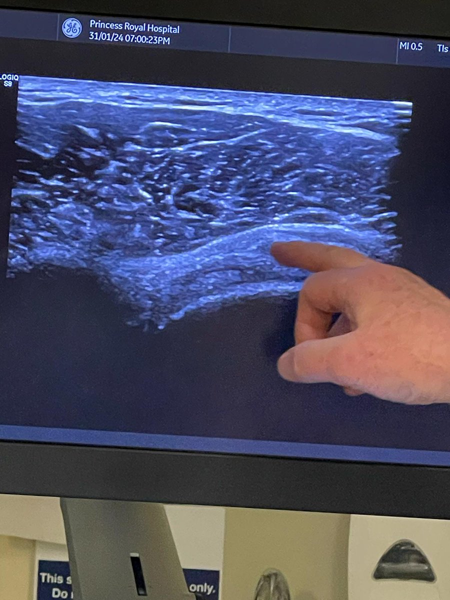 Excellent evening discussing Glenohumeral Joint Injection options | Plantarfascia scanning and Injections | Rheumatology