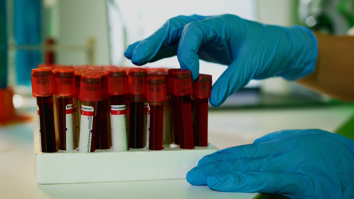 Endothelial Cell News tweet media
