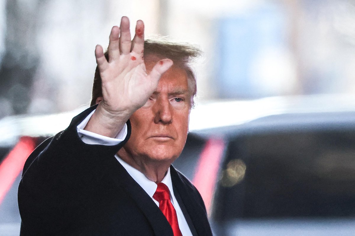 Forbes's tweet photo. Trump Speaks Out On Red Hand Marks: ‘Maybe It’s AI’
https://t.co/758n4kjLyW https://t.co/uSVCQsjSEm