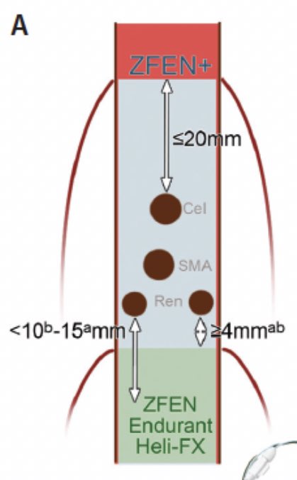 Gustavo Oderich (@gustavooderich) on Twitter photo First fenestrated repair using <a href="/CookMedical/">Cook Medical</a> 4-vessel ZFEN+ fenestrated device at <a href="/UTHealthHouston/">UTHealth Houston</a>. Congratulations to all the team members for playing their essential part. A huge step forward towards individualized surgery: fitting device to patient, not patient to device! First fenestrated repair using <a href="/CookMedical/">Cook Medical</a> 4-vessel ZFEN+ fenestrated device at <a href="/UTHealthHouston/">UTHealth Houston</a>. Congratulations to all the team members for playing their essential part. A huge step forward towards individualized surgery: fitting device to patient, not patient to device!
