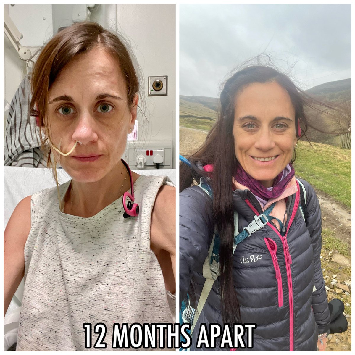 1 year ago I was admitted to The Priory Cheadle unwell with anorexia. I still have a long way to go in recovery, but 365 days on, I celebrated this recovery-milestone with a windy hike in the Peak District! #recovery #anorexiarecovery #eatingdisorders #PeakDistrict #mentalhealth