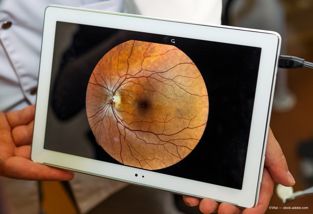 Ophthalmology Times tweet media