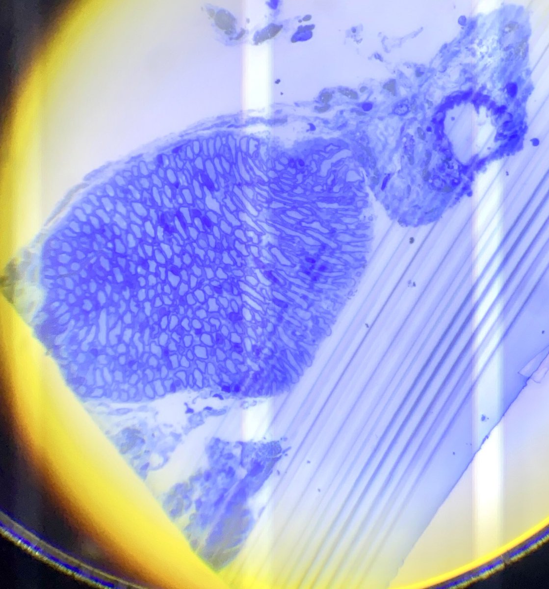 bpradip3's tweet photo. Sectioning is so satisfying because it's like peeling back layers to uncover hidden secrets. It's amazing to see the size difference between tiny nerve axons and a blood vessel. And if you look closely, there's this lone mummified blood cell in the vessel - a tiny, lost world! https://t.co/cr892SnA4z