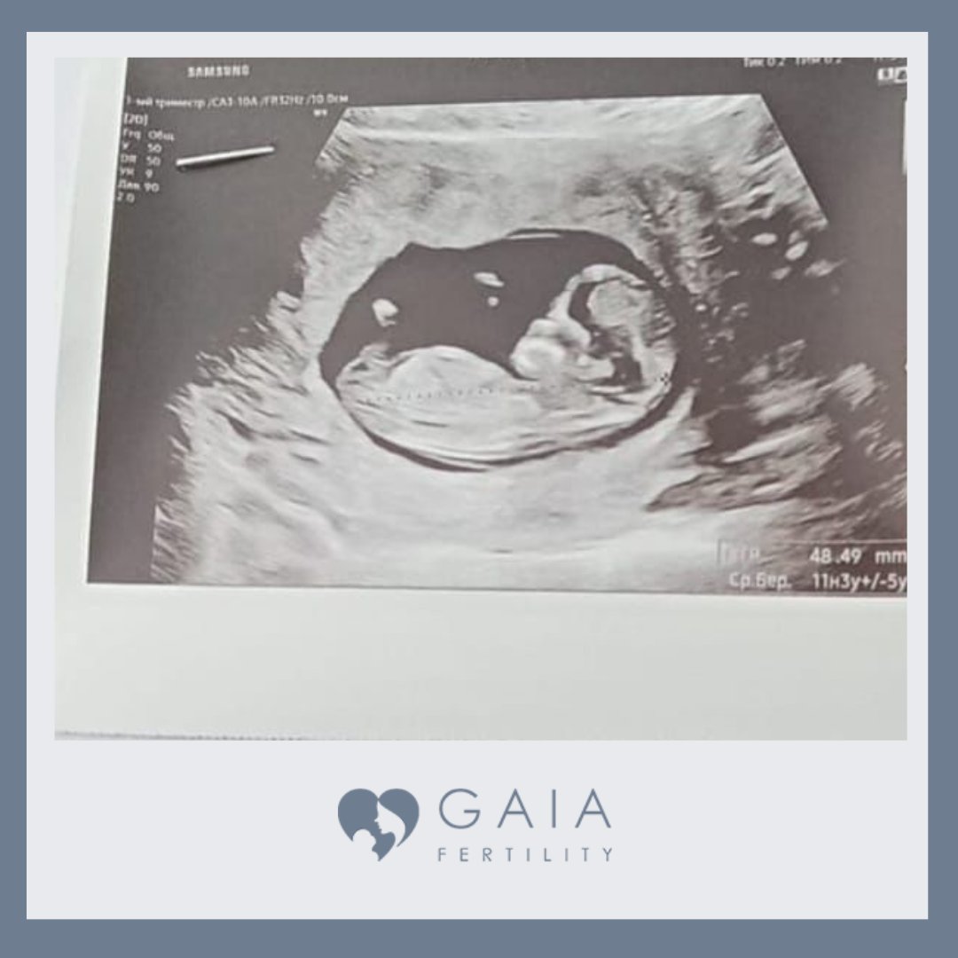 Gaia Fertility tweet media