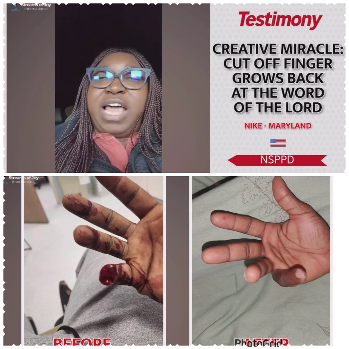 meadwealth's tweet photo. NSPPD ooo😳😳😳😳😳
I’m so shocked!!!! 

Makes no sense!!! How can a finger grow back??

What God cannot do indeed does not exist 
#nsppd https://t.co/Nx9bLVq1F1