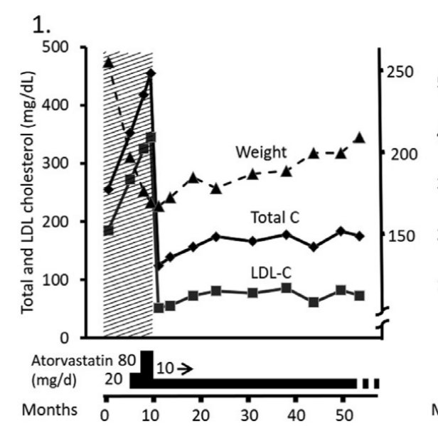 lipo_fan's tweet image. #LEM #LMHR 

@realDaveFeldman @nicknorwitz @DudzLightLime @Clint_OMeley

👌 A male age 65, baseline untreated LDL-C 185 mg/dL. Avid exerciser when a VLC diet

🔥 He lost 84 lbs. over 9 months ▶️▶️ LDL-C ROSE TO 345 MG/DL

🚑 Despite starting atorva 20 mg▶️ subsequent to 80 mg