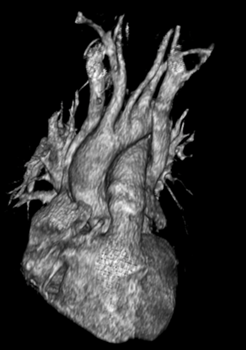 gitalcardiol's tweet photo. #Online only: riscontro ecocardiografico incidentale di dilatazione del seno coronarico: preoccuparsi o no? Per scoprirlo non perdere il caso di imaging cardiovascolare by De Petri, Tezze &amp; Passarini
https://t.co/VLmCflDHyj https://t.co/JMv9DhOokf