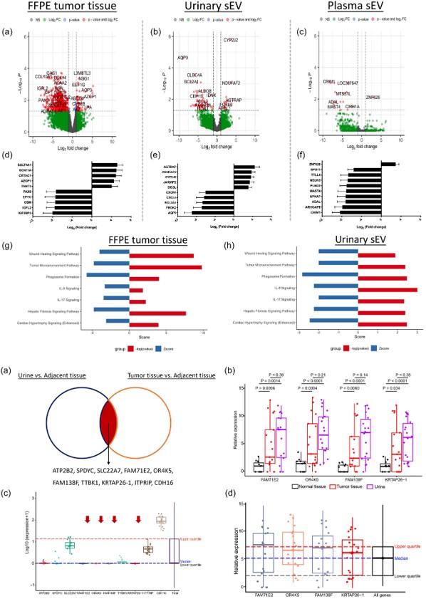 Small EVs as biomarkers for bladder cancer: Ken Pienta at JHU et al conducted RNA sequencing for FFPE tumor tissues and small EVs from matched tissue explants, urine, and plasma in BCa patients isevjournals.onlinelibrary.wiley.com/doi/full/10.10… #extracellularvesicles #exosomes #rna #liquidbiopsy #Vesiculab