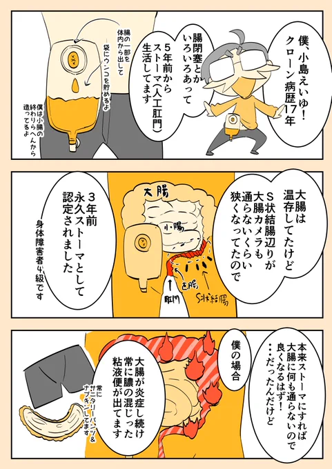 (再掲)大腸から肛門まで全部とる男01(2/2)
#漫画がよめるハッシュタグ #エッセイ漫画 