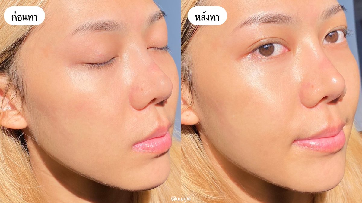 UunJai's tweet photo. เรตินอลเป็นอีกตัวที่จำเป็นกับผิวมากๆ ใครกังวลหรือมือใหม่หัดใช้แนะนำของ CeraVe เป็นเรตินอลสูตรอ่อนโยนใช้ร่วมกับตัวอื่นใน routine ได้ ไม่แสบไม่ยิบ ผิวเนียนขึ้น+รอยดำจากสิวลดลง ใช้ไปเรื่อยๆพอสิวหมดหน้าใสเป็นกระจกเลย https://t.co/rEhL3SCsAr