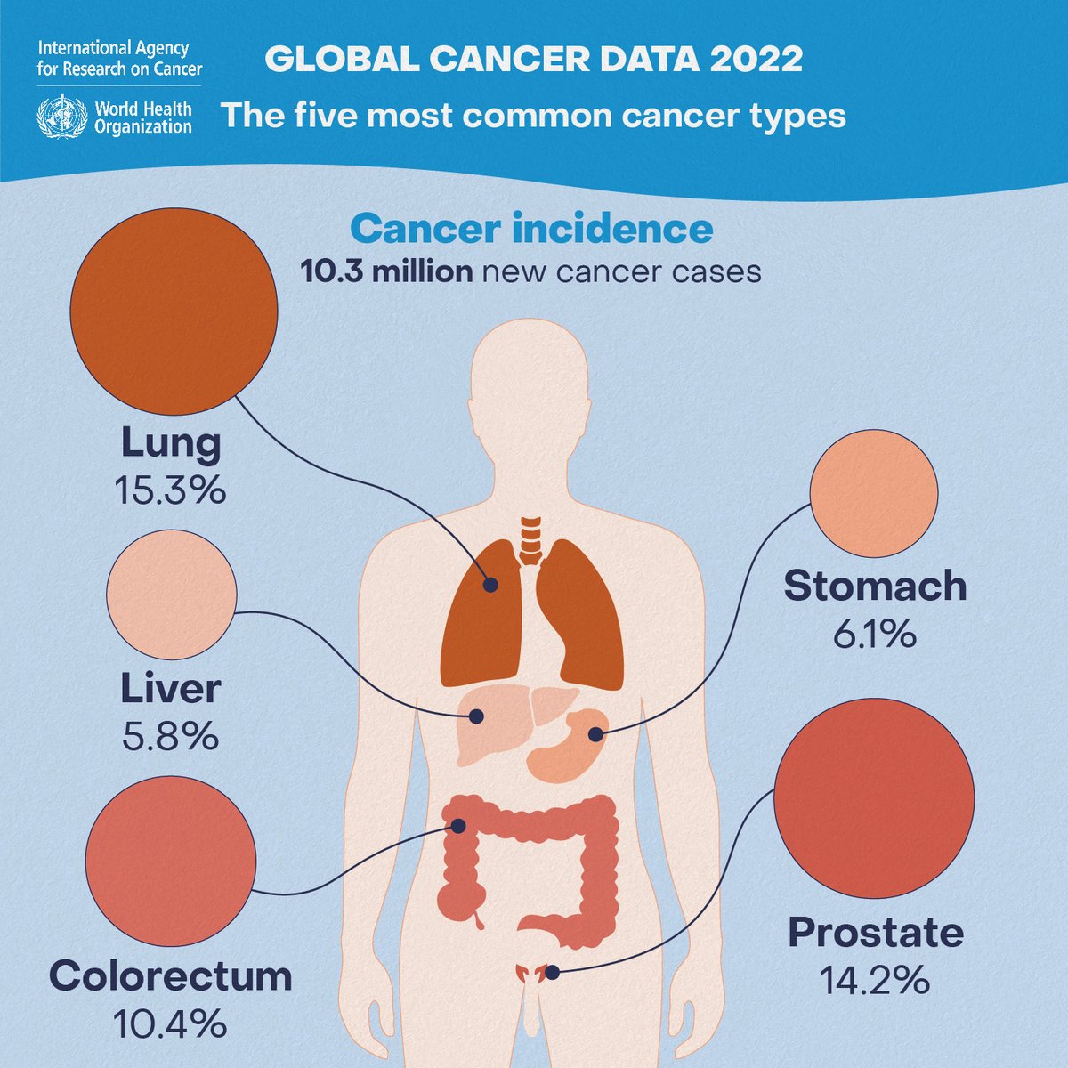 #LungCancer was the most commonly occurring cancer worldwide in 2022 with 2.5 million new cases, almost 1 in 8 of all new #cancer cases.
Female #BreastCancer, estimated to be the most common cancer in 2020, ranked 2nd with 2.3 million cases.