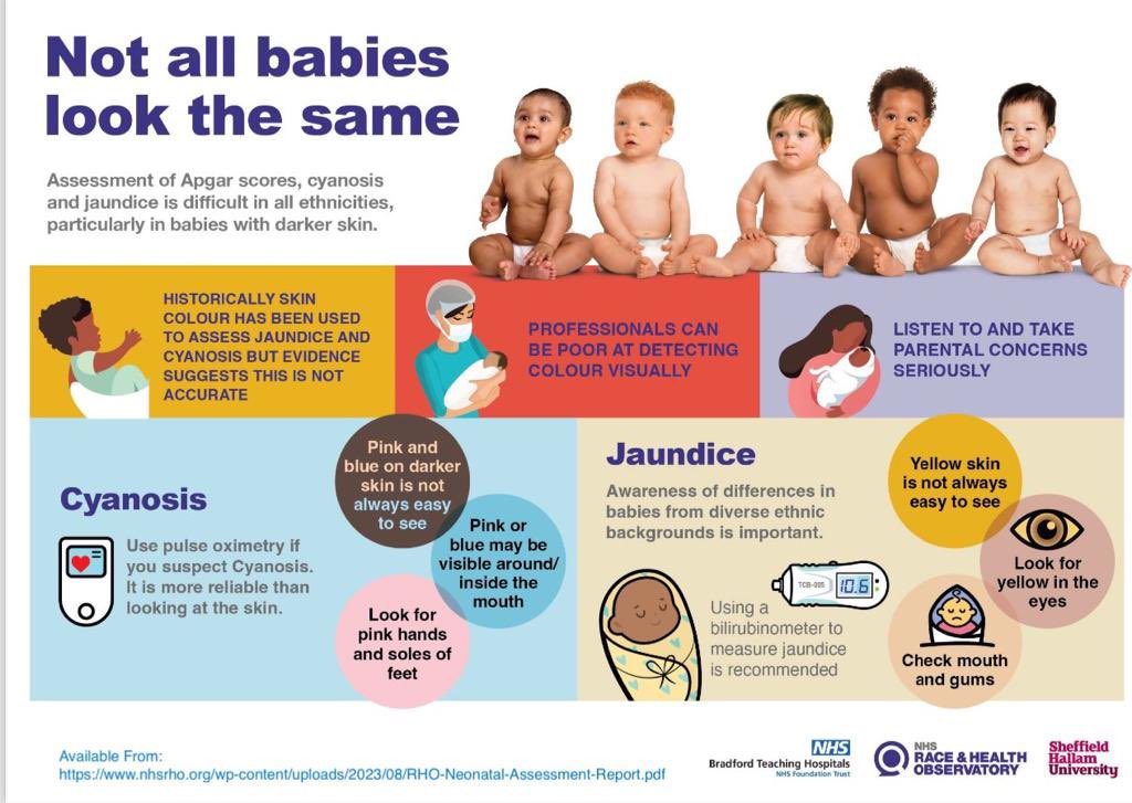 wabbasy's tweet photo. When assessing babies with darker skin, not all babies look the same https://t.co/es1QBDEXCe
