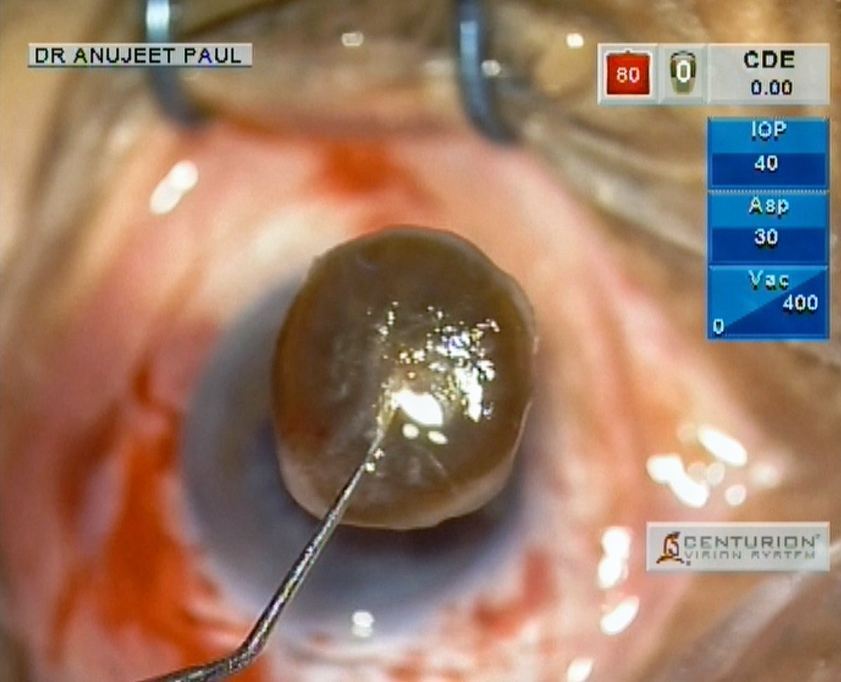 Dr. Anujeet Paul tweet media