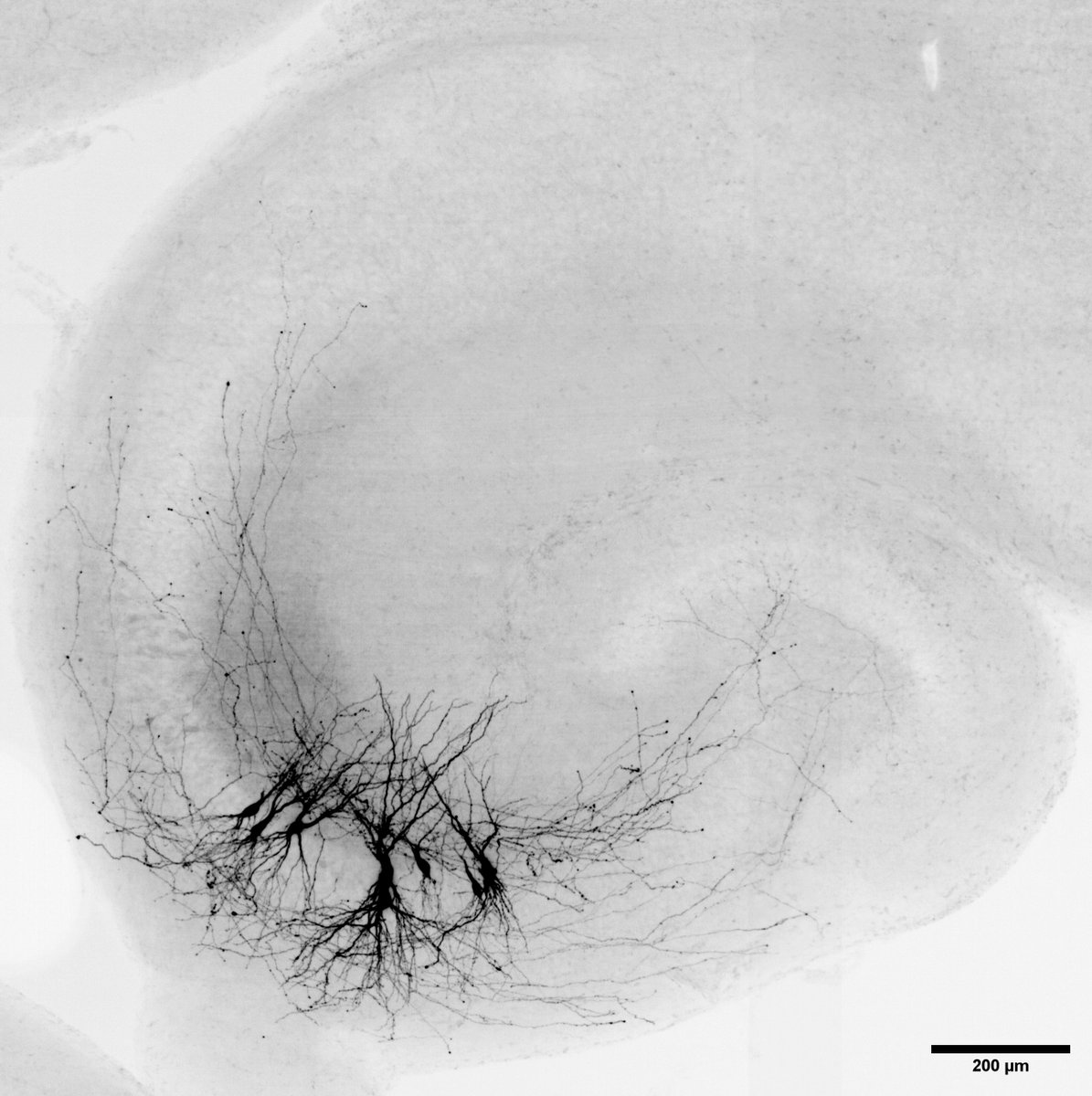 What a beauty! Pyramidal neurons in CA3 #patchclamp #neuroscience #hippocampus