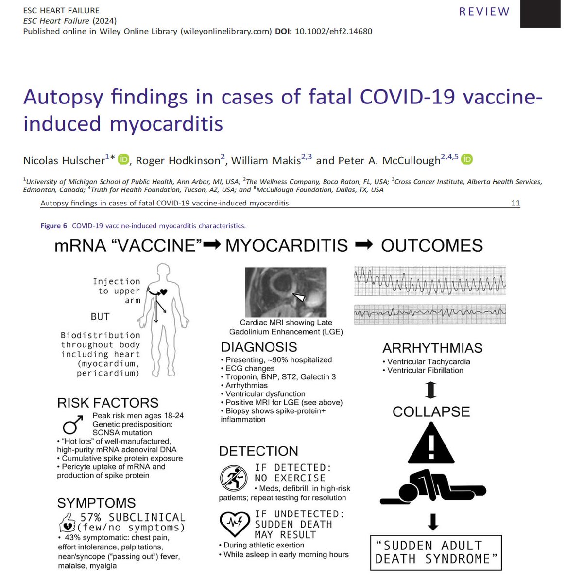 robinmonotti's tweet photo. CALLING ALL DOCTORS!
No need to be "baffled" any longer!
SUDDEN ADULT DEATH SYNDROME explained by scientific paper. Visuals: https://t.co/tPBC0UuBkf