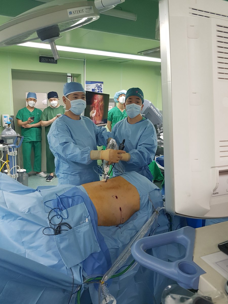 Chang Wook Jeong (@drboss_urology) on Twitter photo The world's first HyperQure #RDN by Pf. Jung Ki Jo under my guidance at Hanyang Univ. Medical Center.
HyperQure is a novel extravascular #RDN to cure resistant #Hypertension. SBP changes: 160mmHg --> 110mmHg
<a href="/jaimelandmanuci/">Jaime Landman</a>
<a href="/jeffcadeddu/">Jeff Cadeddu</a>
<a href="/Kandzari/">David Kandzari</a>
#UroSoMe #MedTwitter #UroTech The world's first HyperQure #RDN by Pf. Jung Ki Jo under my guidance at Hanyang Univ. Medical Center.
HyperQure is a novel extravascular #RDN to cure resistant #Hypertension. SBP changes: 160mmHg --> 110mmHg
<a href="/jaimelandmanuci/">Jaime Landman</a>
<a href="/jeffcadeddu/">Jeff Cadeddu</a>
<a href="/Kandzari/">David Kandzari</a>
#UroSoMe #MedTwitter #UroTech