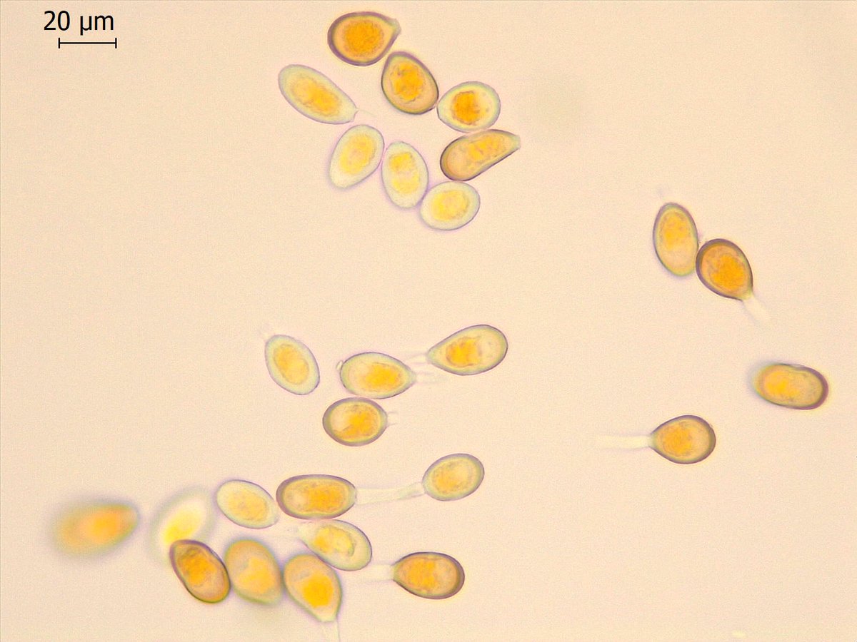 PretoriusZak's tweet photo. @striiformis @LandbouLisa Urediniospores from pustules on Dactylis leaves (left) and stems (right). Specimen may have mixed infection. https://t.co/r4f6vqZW2i