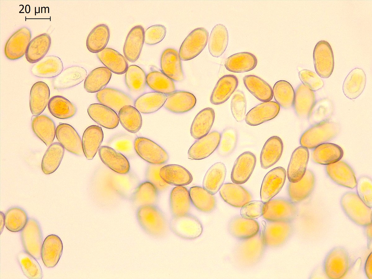 PretoriusZak's tweet photo. @striiformis @LandbouLisa Urediniospores from pustules on Dactylis leaves (left) and stems (right). Specimen may have mixed infection. https://t.co/r4f6vqZW2i