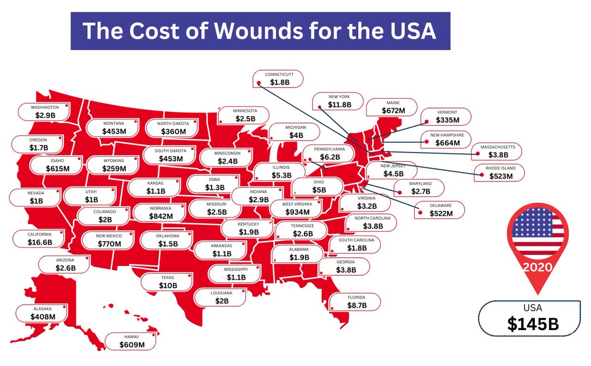 The Estimated Costs of Wounds in the USA and Its States: The International Wound Journal recently published an editorial showing what the USA and its individual states could be spending on managing wounds. onlinelibrary.wiley.com/doi/epdf/10.11… #woundcare #wounds #costs #IWJ #USA