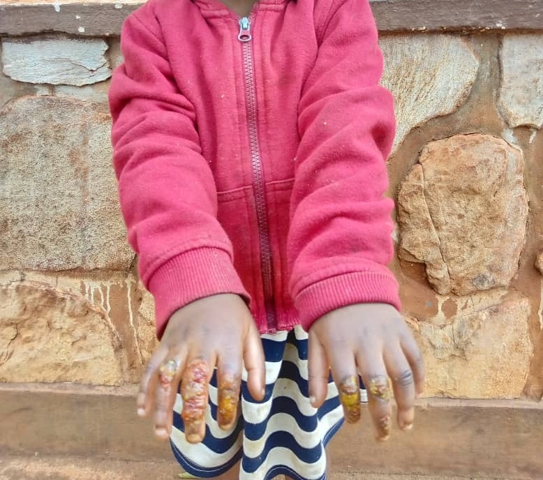 MagazineJimbere's tweet photo. 🤚🏾 Accusée par ses voisins d'avoir brûlé à l'eau chaude les doigts de la fillette de 4 ans de son mari, une femme habitant au quartier #Shikiro de la commune #Ngozi a été arrêtée ce 01/02/2024

🙅🏾‍♀️ "La femme soutient que l'#enfant se serait elle-même brûlée", informe la Police, en précisant qu'une enquête est en cours

#Burundi